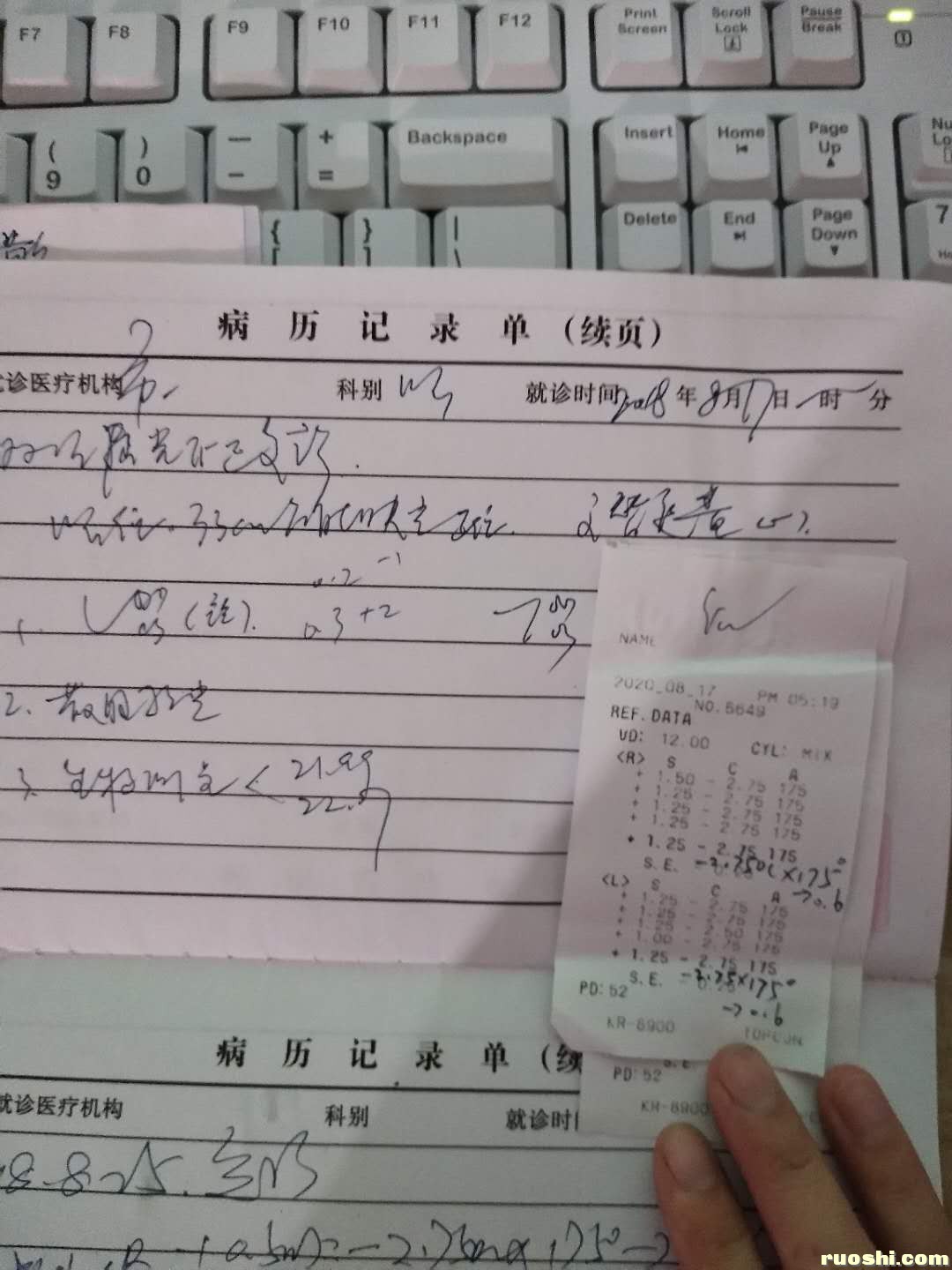 这是最近一次的散瞳结果