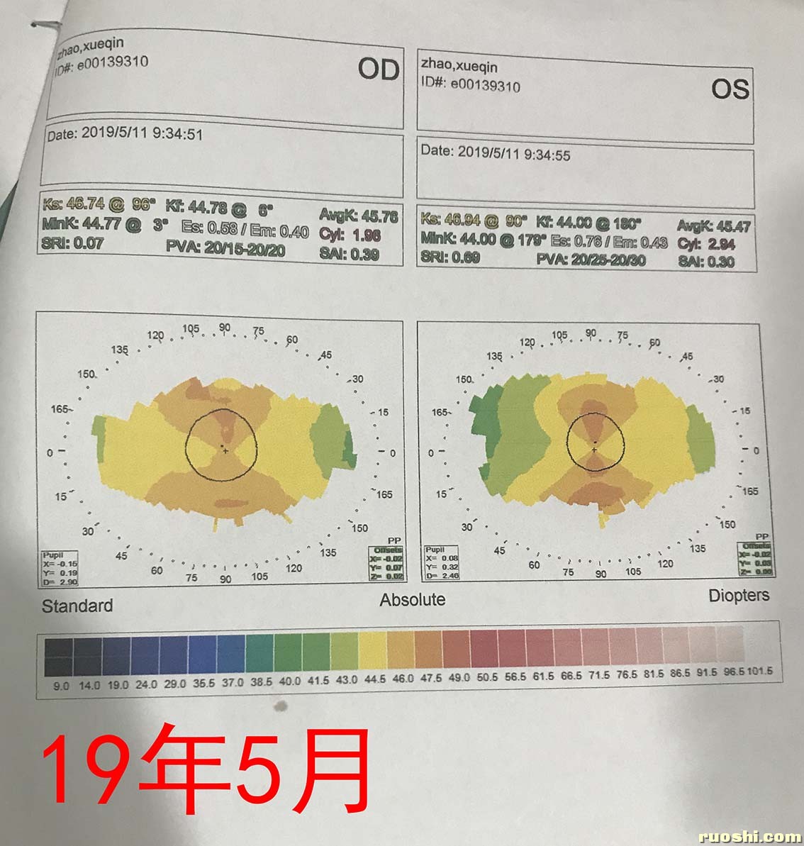 19年角膜地形图.jpg