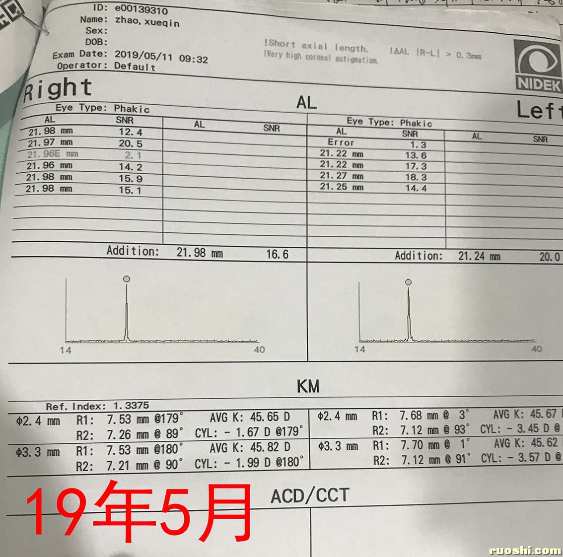 19年眼轴检查.jpg