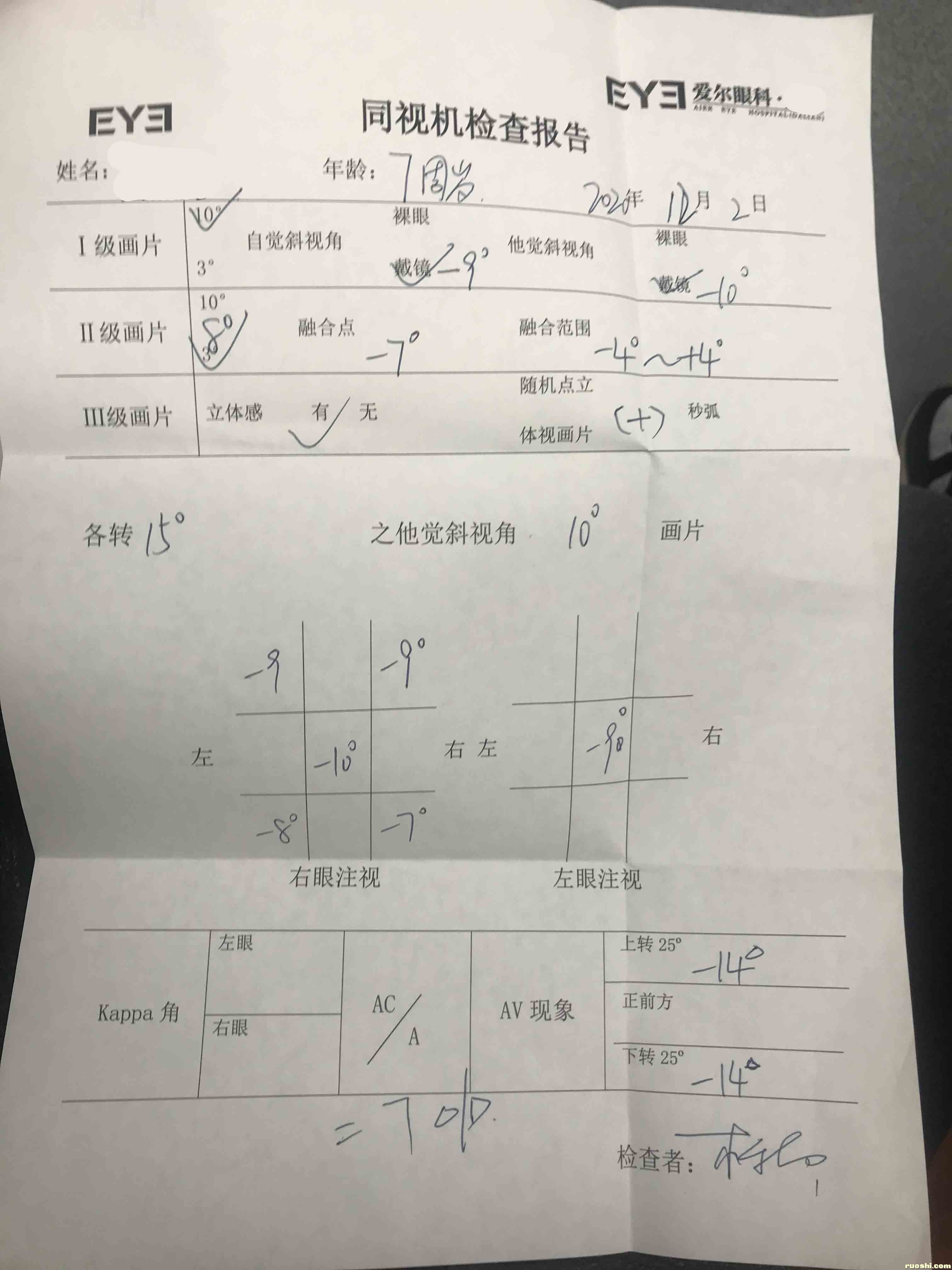 爱尔眼科同视机检查