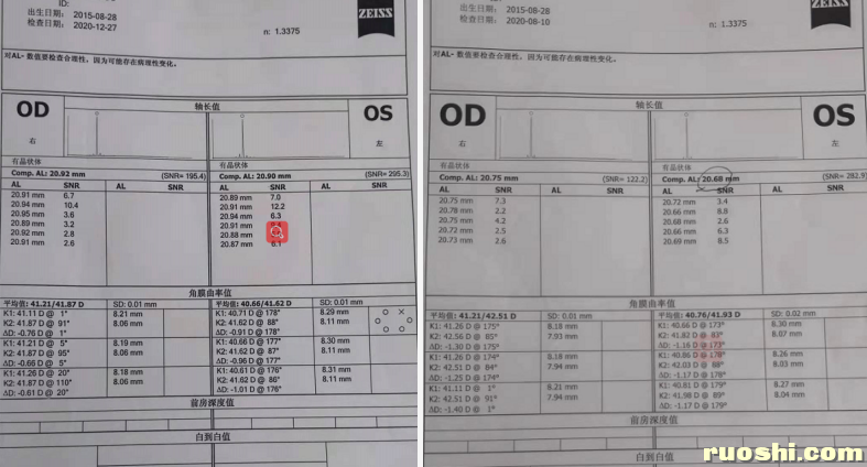 最近两次检查资料