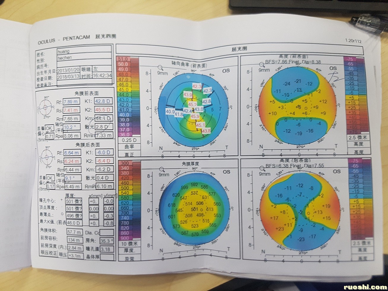 3月13日屈光图（1）