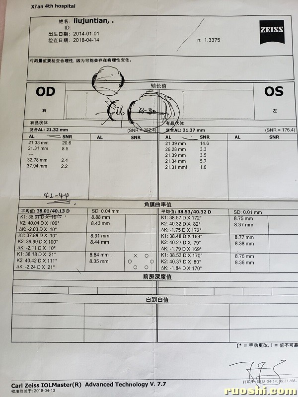 11-2018年4月14号眼轴曲率检查单（四院）11