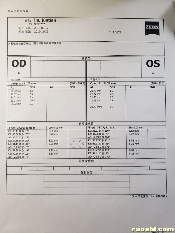 14-2019年11月22号眼轴曲率（四院）1