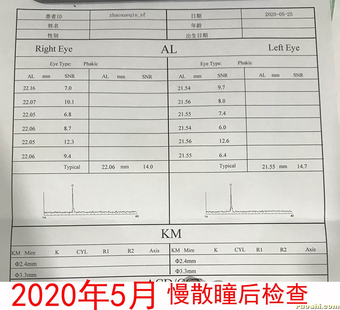 20年眼轴检查.jpg