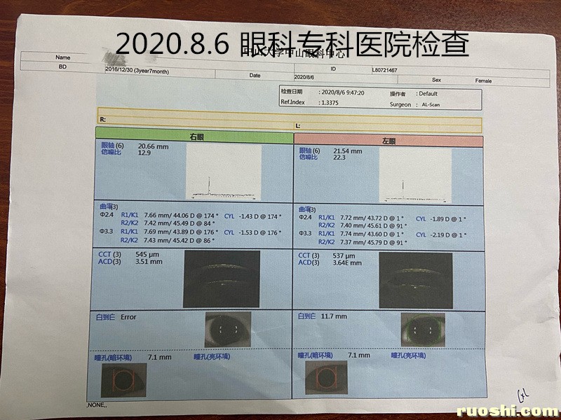 2020.8.6 眼科专科医院检查单